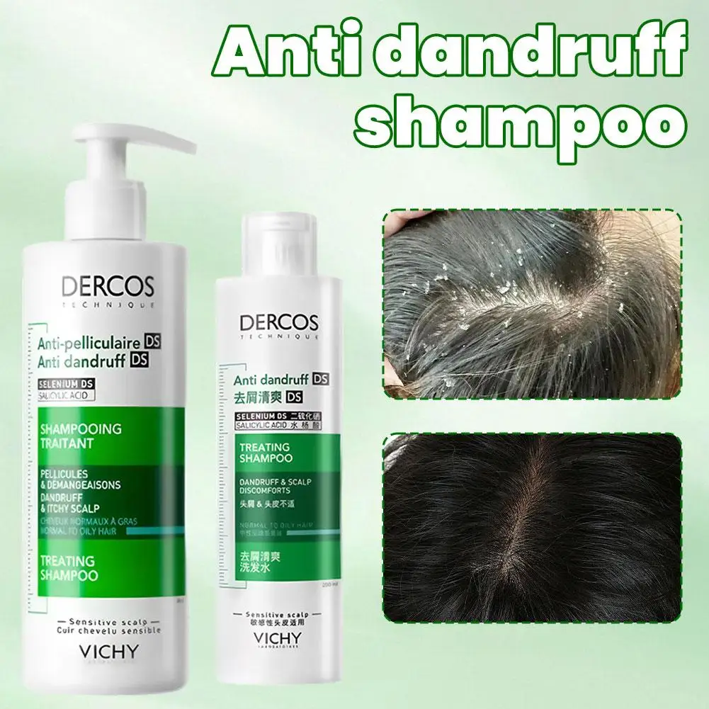 kf-Sc3d8bd4325a24d6491eb4053dcd3db7aV Vichy Anti-danddruff Shampoo Fluffy Shampooing Hair Conditioner Soothing Damaged Hair Treating Refreshing Oil Control Hair Care - Image 1
