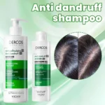 Vichy Anti-danddruff Shampoo Fluffy Shampooing Hair Conditioner Soothing Damaged Hair Treating Refreshing Oil Control Hair Care - Image 2